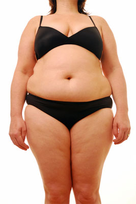 Liposuktion bzw. Fettabsaugung zur Gewichtsreduzierung - Warum es nicht funktioniert Liposuktion, Fettabsaugen, Abnehmen, Gewichtsreduktion, Gewicht, reduzieren, funktioniert, nicht